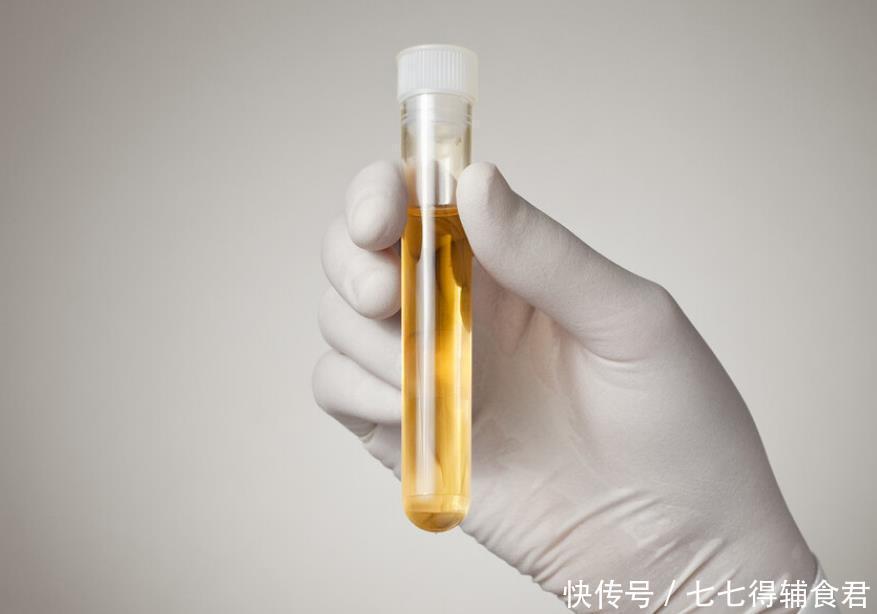 肝脏的“黄金搭档”找到了,不是菊花,平时可劲喝,肝脏越发健康