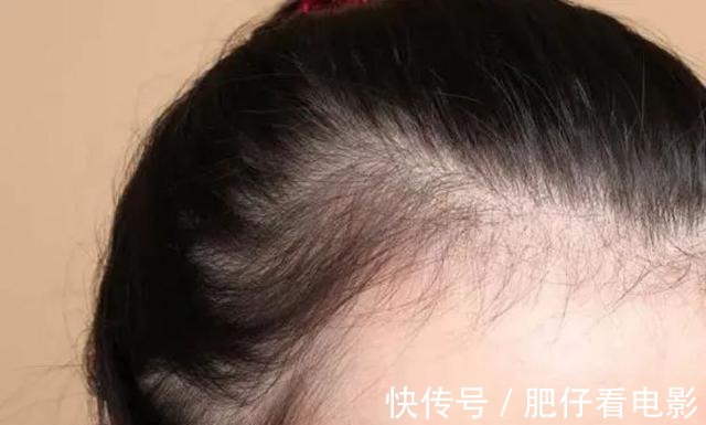 小仙女 巨好看的刘海发型,瞬间拯救大额头!发际线高的一定要试试!