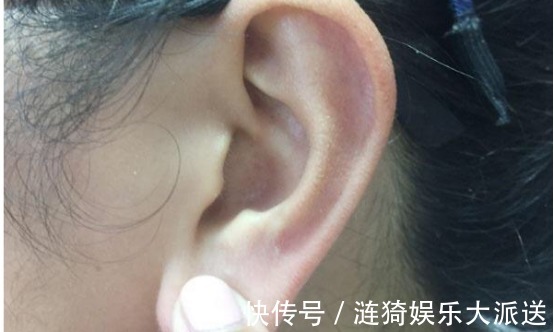 症状|当身体出现以下五种症状,多半是长寿的象征,别以为是生病!