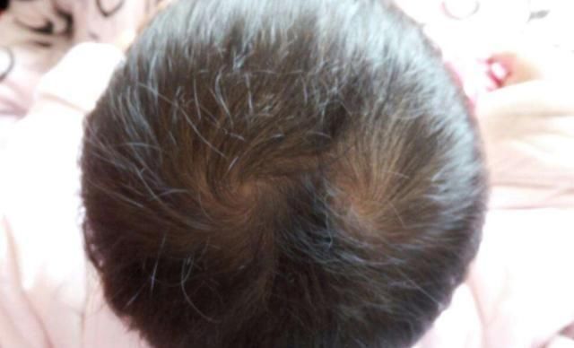 孩子|头上有“2个旋”的宝宝,是性格更好还是命更好?家长别分不清