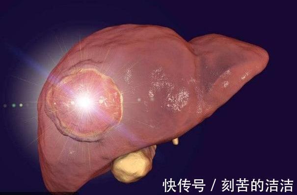 睡眠时间|江西一女子,坚持每天吃胡萝卜养肝,3个月后,肝脏有什么变化