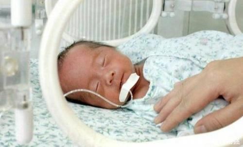 新生娃|新生娃出生7天迟迟不睁眼,父母急忙送医后,医生却不厚道的笑了