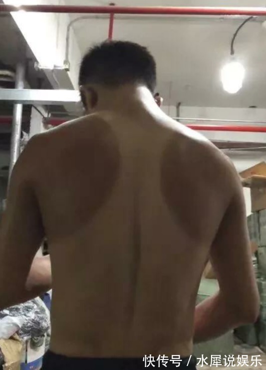 大赛|男子晒“渐变色”皮肤，网友不服，一场“比惨”大赛开始了