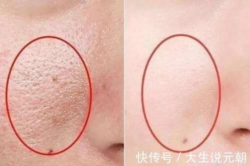 敏感肌|长期素颜和每天化妆的女人,坚持10年后,皮肤差异巨大