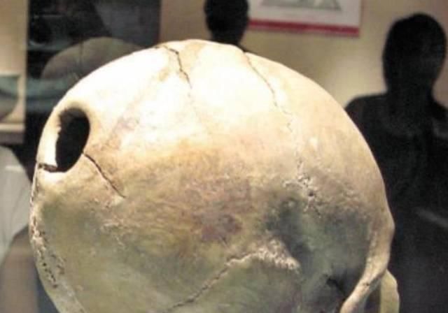 劈开|如果华佗把曹操的脑袋劈开,真能治好他的头风吗