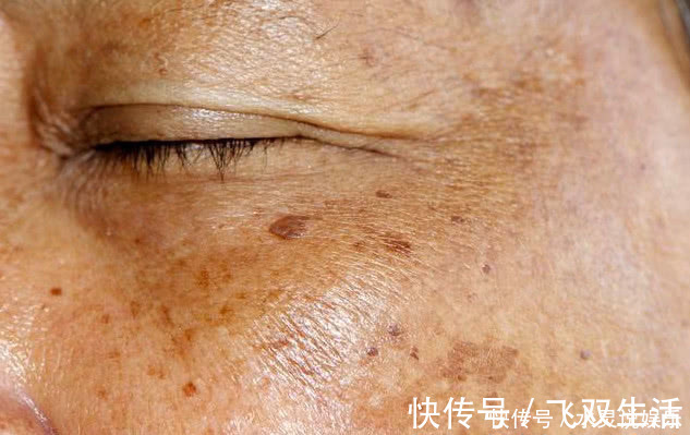 肝毒|脸上有3个信号，说明肝毒太多，4个简单方法可养好肝脏