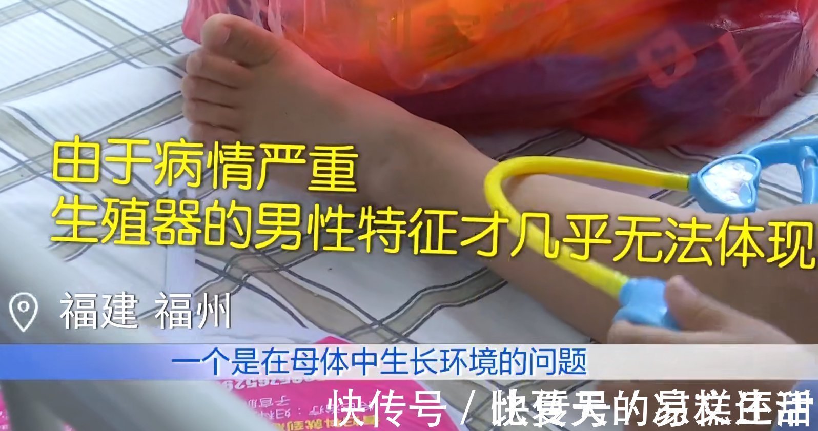 孩子|女童被养到三岁大,到医院一查是个“纯爷们”,医生也是头一次见