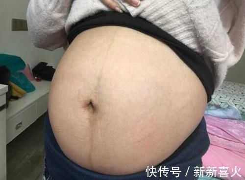 妈妈|想了解胎儿发育情况，可以看看孕妈的肚脐，“凸出来”的要恭喜了