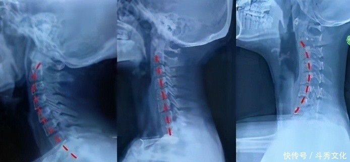 肩膀疼痛,并非肩周炎,问题在哪?您找对没?此文给您全新的认识
