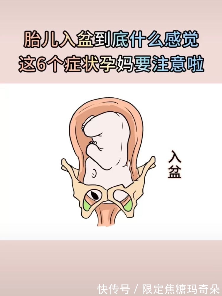 准妈妈|胎儿入盆就是要生了吗?5大征兆表示已入盆