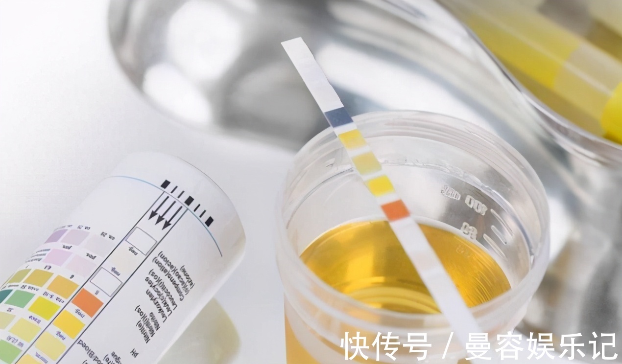 降酸|食物中“嘌呤大户”被发现,比猪肉含量高42倍,医生:白给也不吃