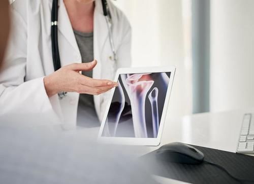 骨质疏松|骨疏松的发物是花生吗?医生:要想骨头好,这“2绿”尽量少吃