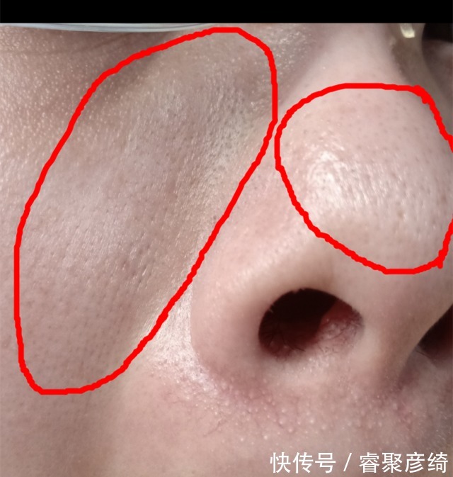 洗脸|为什么我的爽肤水不好用?