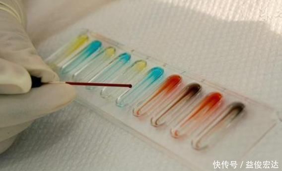 流产|女人若是这两种血型,第一胎尽量别流掉,可能对你和孩子都好