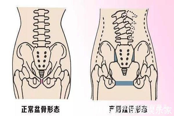 女性|女性生没生过孩子，4个部位会出卖你，想要瞒住不容易