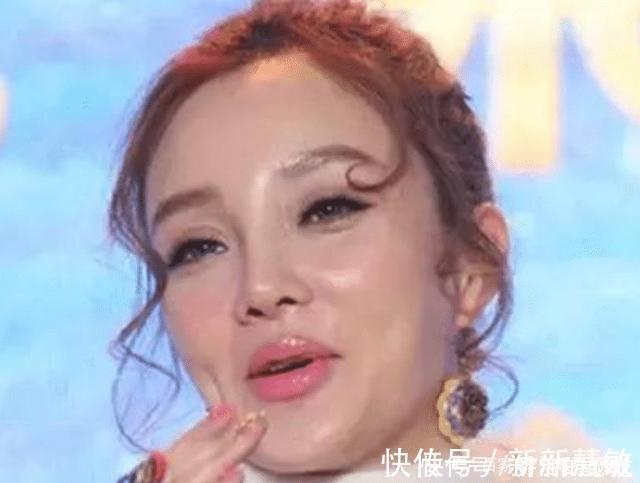 私人订制|被玻尿酸毁掉的女星,容貌前后变化太大,一般人根本认不出!