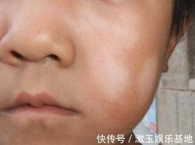 孩子|孩子有这6大症状,表明肚子里长了“蛔虫”,家长们要重视起来!