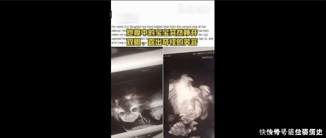 b超|孕妇做B超被吓坏,孩子突然睁眼怪笑!医生却说……