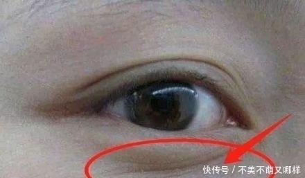 黄褐斑|子宫健康的女性,脸上不会有4种表现,常喝1种水,子宫更光滑