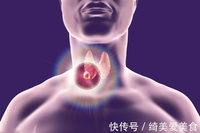 慎用|逍遥丸可降血脂,但用对才“逍遥”,3类人不能吃,有你吗?