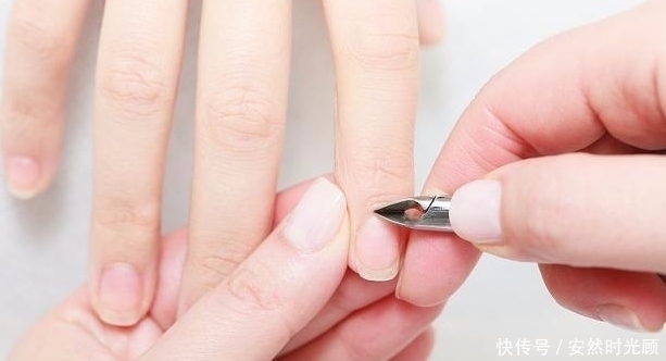 指甲盖|手指甲为什么会出现“竖纹”？这4个原因，最好了解一下！