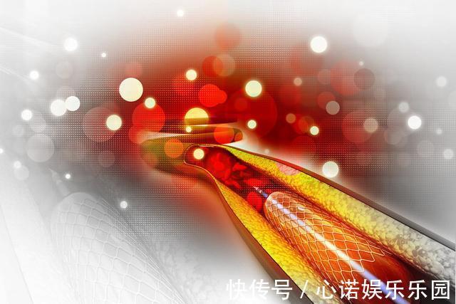 支架|做了心脏支架，病人就活不久了？实话实说，6类人群不适合做