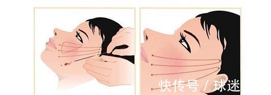 大拉皮 王小民教授做小拉皮的人逐渐增多,网上传言却没有效果!