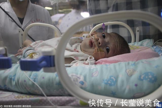 杨小平|泪目!女子求助无门欲拔掉娃的氧气时,孩子突然伸手给她擦眼泪