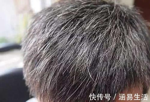 防病|经常按摩身体这6个部位,不仅能防病养生,还可以延年益寿!