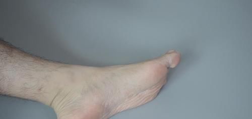 吃剩的香蕉皮“半点”都别扔,用途太厉害了,好多人都不懂,学学