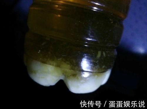 睡眠时间|糖尿病,会出现“1降1白3多”的提示,做好3件事,血糖慢慢降