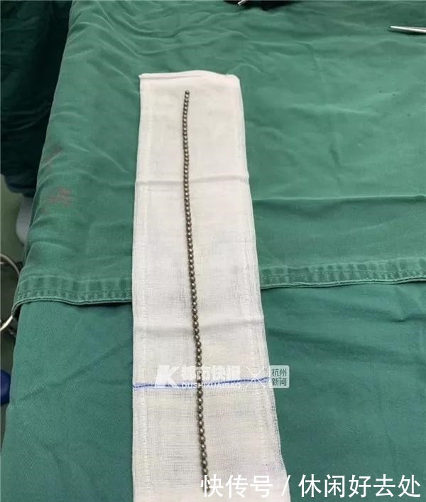 11岁男孩将70颗磁力珠塞尿道,医生呼吁别给孩子买了!