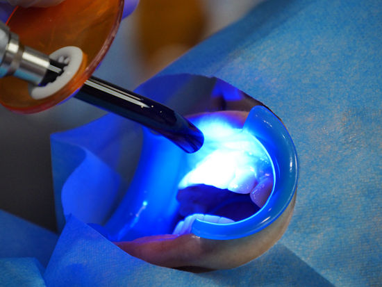 苏建宏|打地鼠式牙齿保卫战