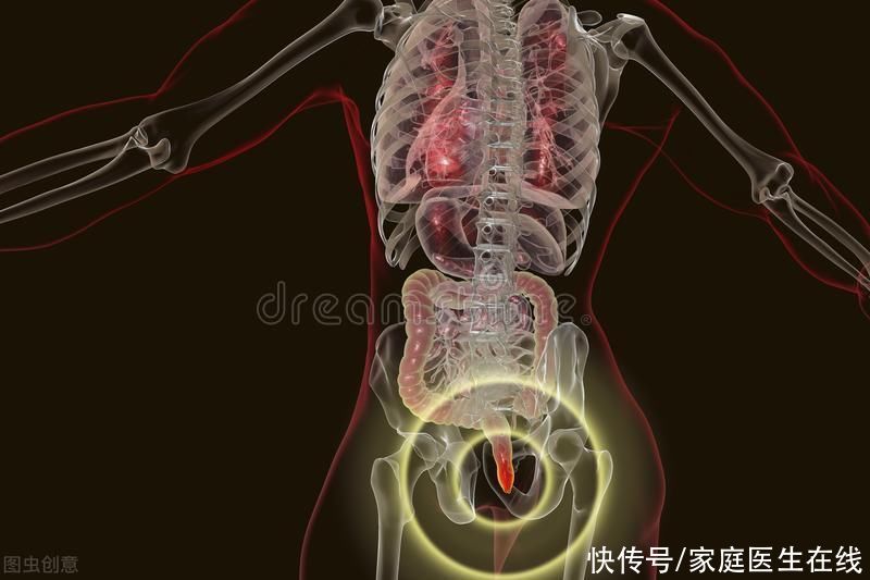 肛门|得痔疮皆因坐太久？还有其他原因导致的，这5个原因希望你早点知道，别得了才后悔