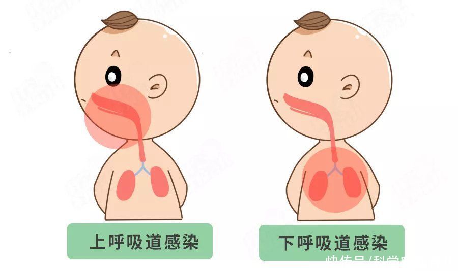 天花|娃“感冒”后进ICU,5天花20万!还认不出肺炎征兆?快学
