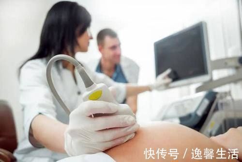 孕妇|这4项检查令孕妇叫苦不迭,麻烦不说还提心吊胆,你查到哪个了?