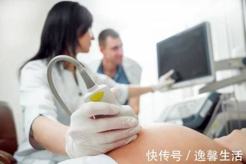 孕妇|这4项检查令孕妇叫苦不迭，麻烦不说还提心吊胆，你查到哪个了？