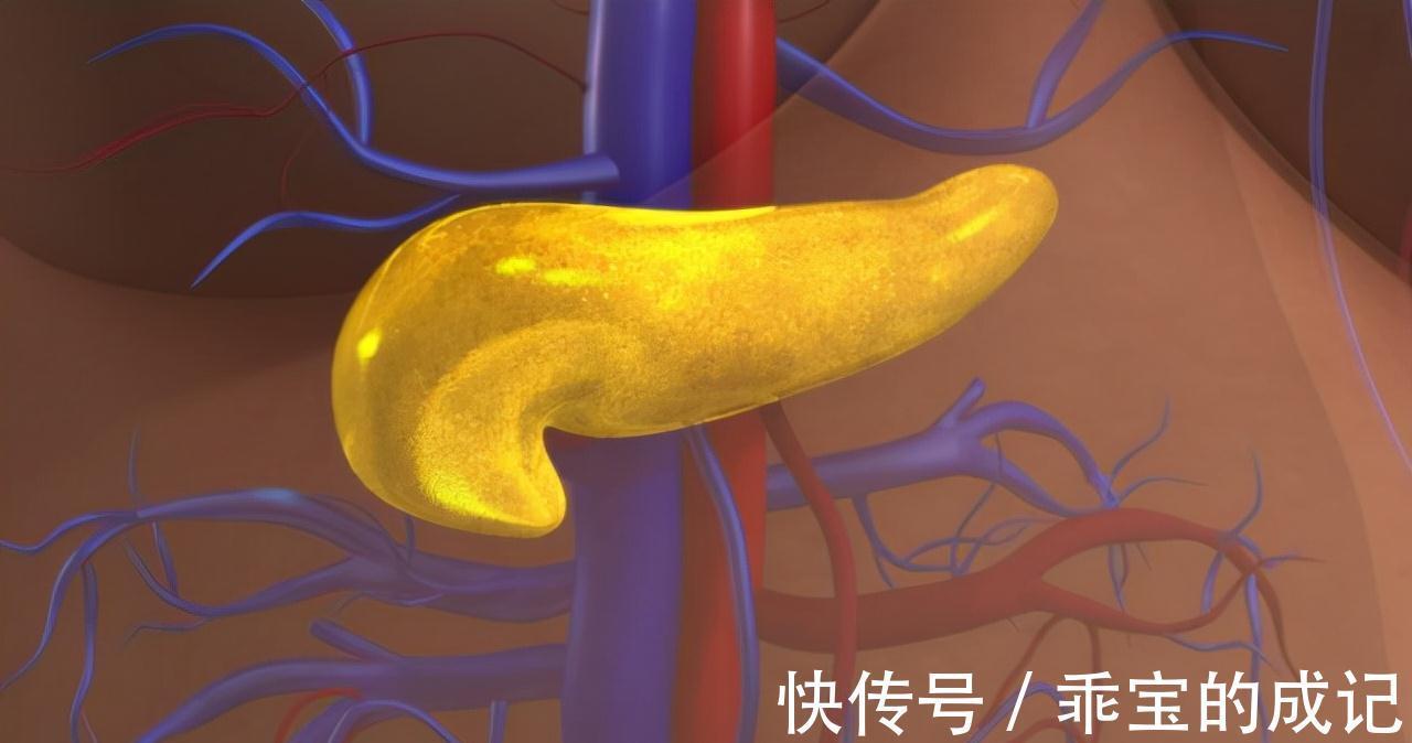 腹痛|胰腺癌被称为“癌王”?有6大类高危人群,有哪些典型的征兆?