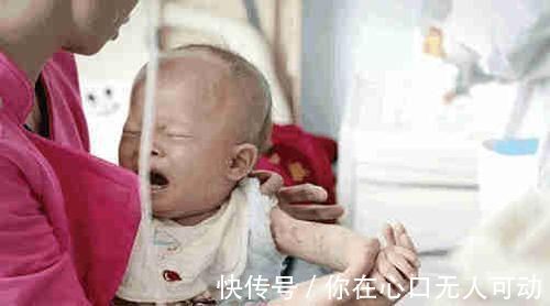 孩子|孩子烫伤后, 最佳治疗时间只有2分钟, 你知道该怎么做吗