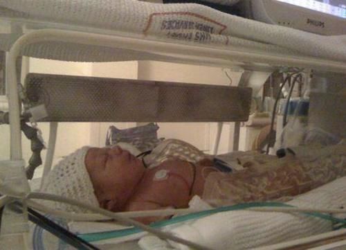 怀孕|6个月女宝肚子胀得像怀孕,家人赶紧送医院,医生:还好来得及时