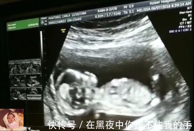 中期孕|除了睡觉,胎儿如何每天在肚子里都干啥宝宝小日子开心到飞起