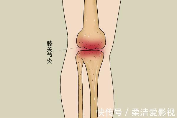 张大爷|每天坚持晨跑五公里,六旬老人,最后换来了什么结果?