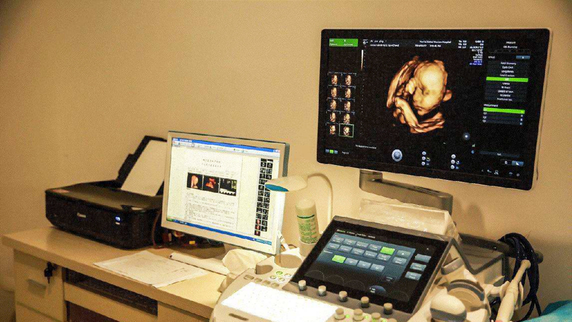 教育方式|胎儿在孕期有三种“信号”,那恭喜你有福了,宝宝将来很聪明