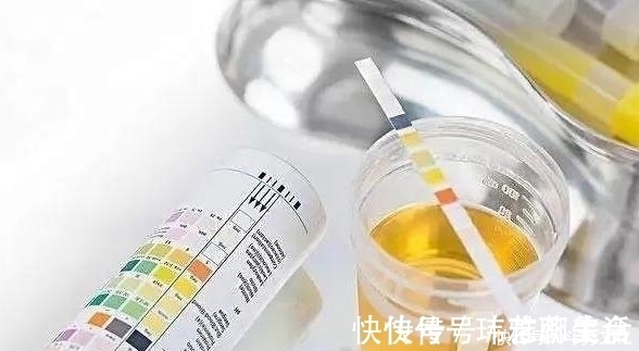 肾小球|糖尿病人尿中有泡沫，两个+专家谈治疗方案