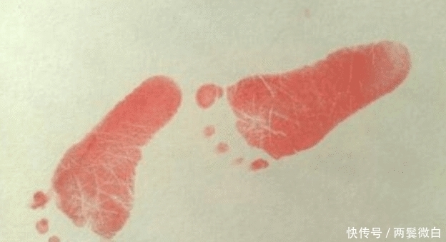 新生儿|新生儿出生后为什么要留脚印?医生没告诉,但家长也要知道