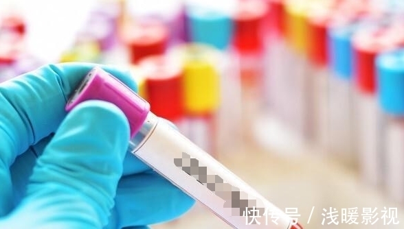 血栓|医生直言:身体若有4种表现,血脂或已“失控”,劝你及时检查