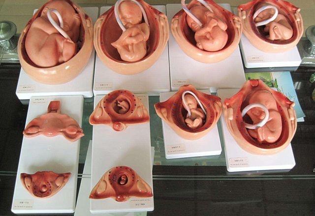 胎儿|胎儿有心跳后,不管因为什么都别打掉他,医生引产过程太残忍