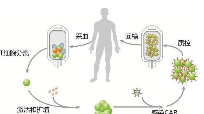  癌症|不做手术和放化疗，增强免疫力可以战胜癌症吗？看专家怎么解释