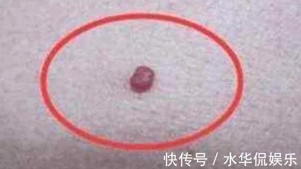 肝净如新|天然“解毒王”来了，没事吃两口，修复肝细胞，让你“肝净如新”