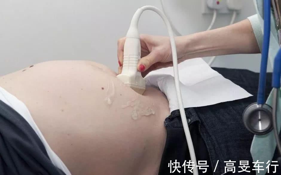 胎动|十月怀胎,这个周是胎儿脐带绕颈“高发期”,孕妇要早知道早预防